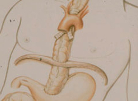 speiseroehre-1.jpg speiseroehre-1.jpg