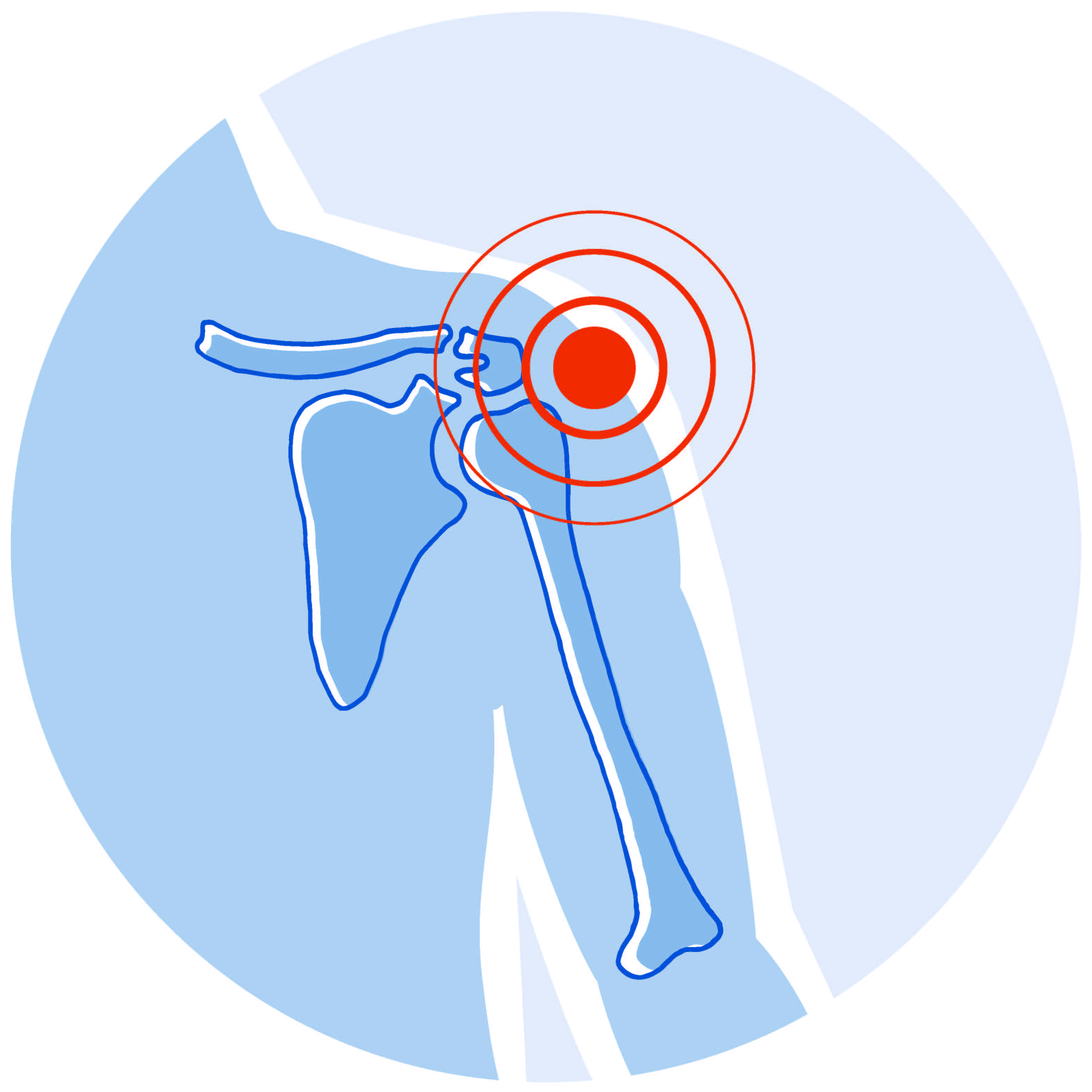 Patientenforum: Schulterschmerzen?