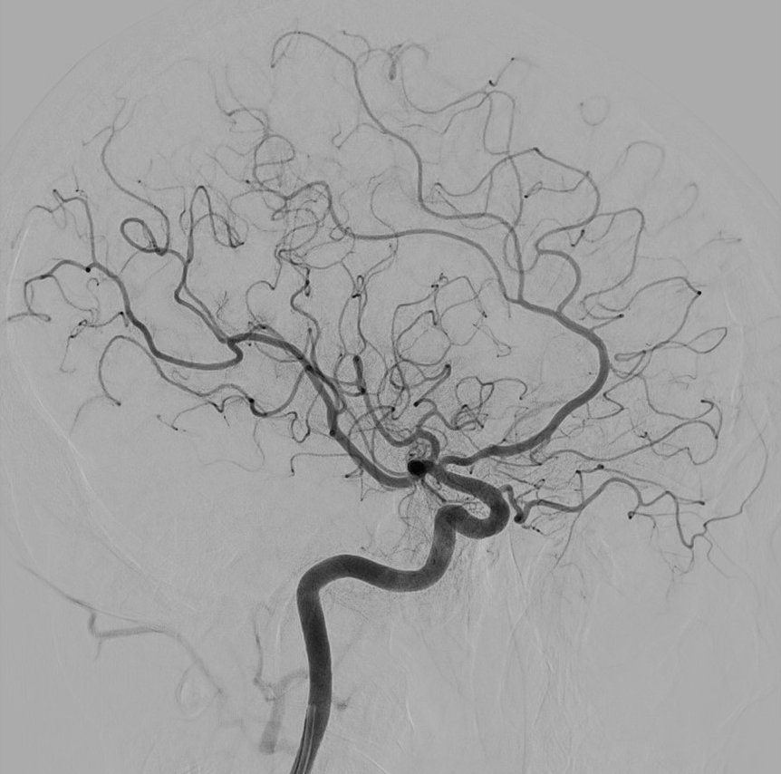 27_KHAUG_RAD_Angiographie_Gefaessdarstellung21092017.jpg 27_KHAUG_RAD_Angiographie_Gefaessdarstellung21092017.jpg