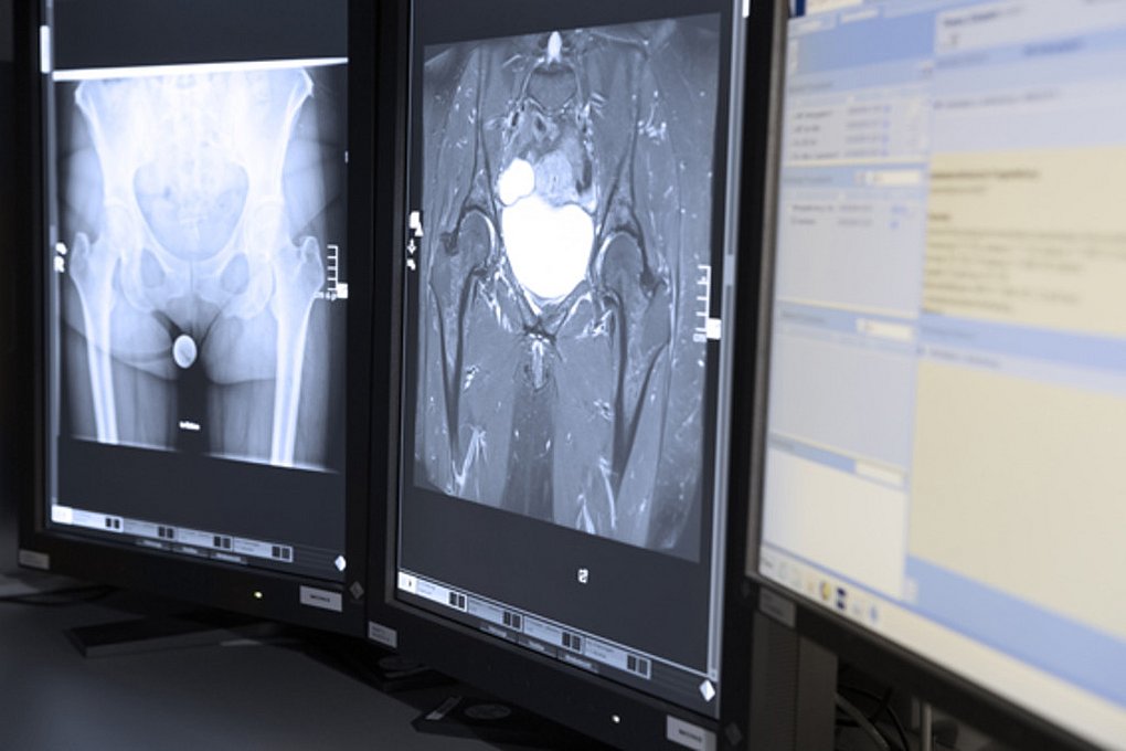 27_Radiologie_DigitalRoentgen1.jpg 27_Radiologie_DigitalRoentgen1.jpg