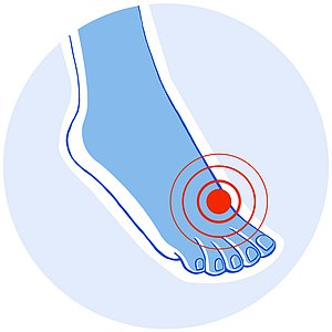 Patientenforum: Fußschmerzen?